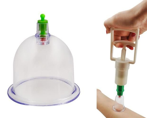 Chinese vacuum cupping