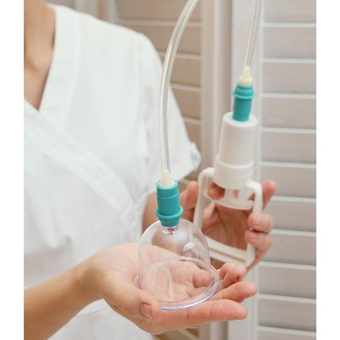 Chinese vacuum cupping